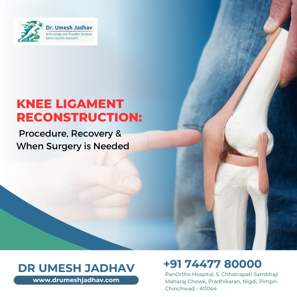 knee ligament reconstruction treatment in pcmc