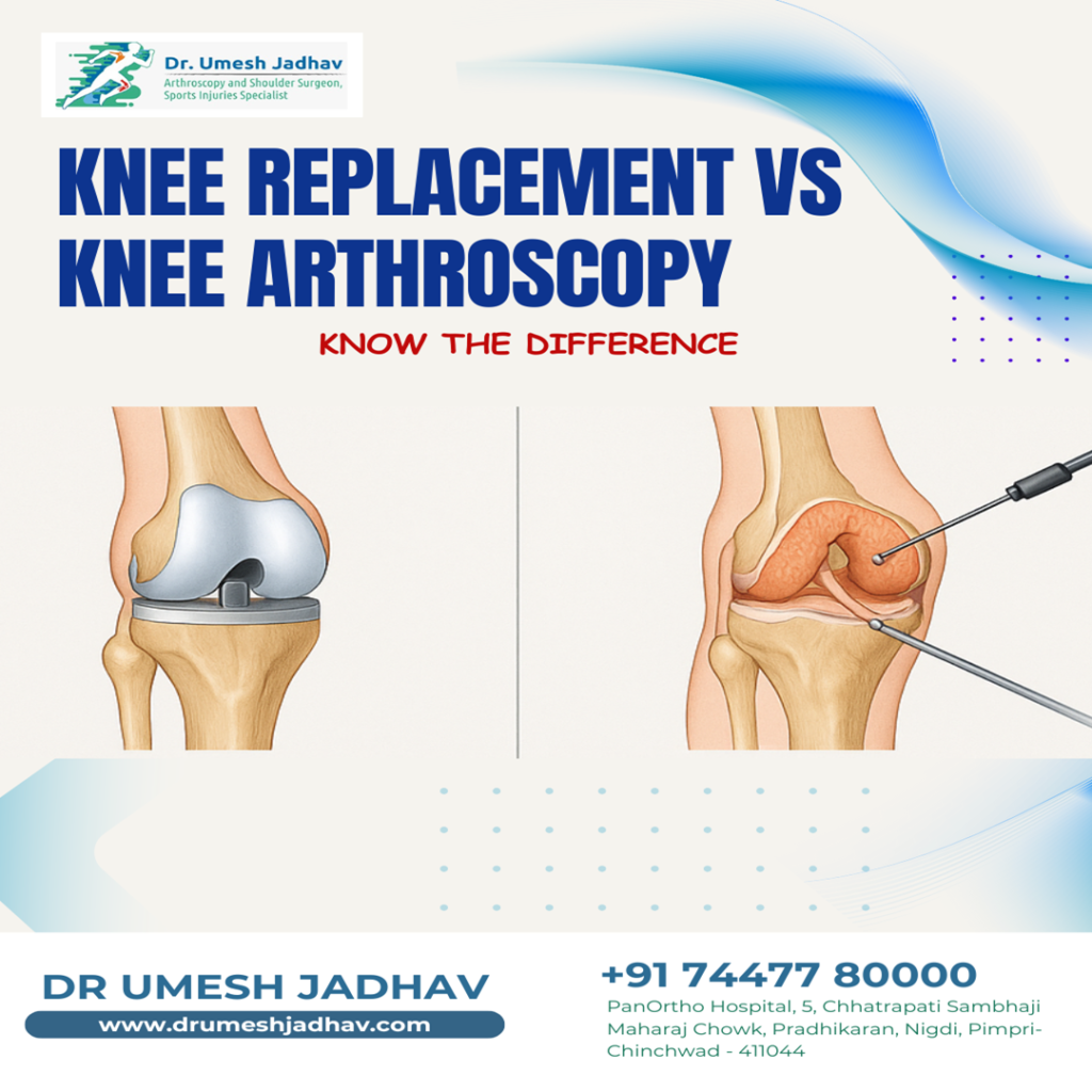 knee replacement vs knee arthroscopic surgery