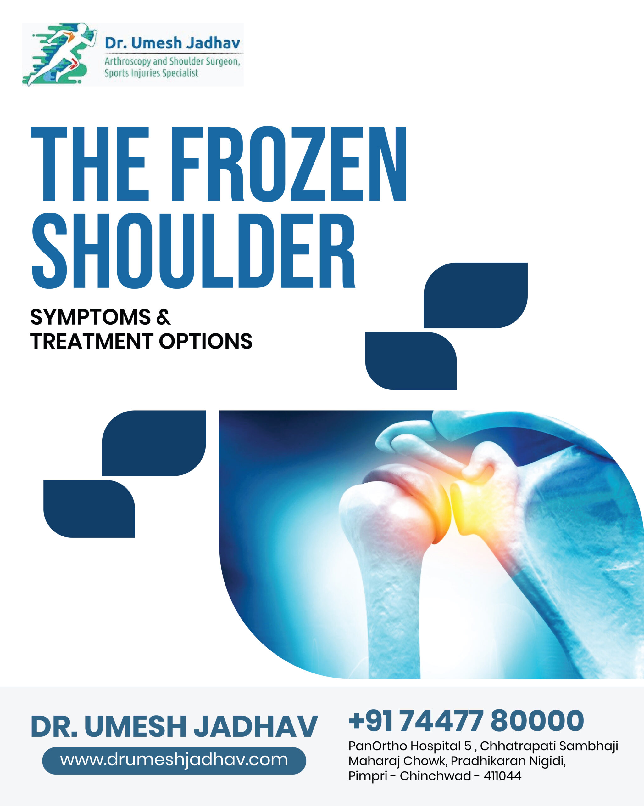 Frozen Shoulder Symptoms and Treatment Options