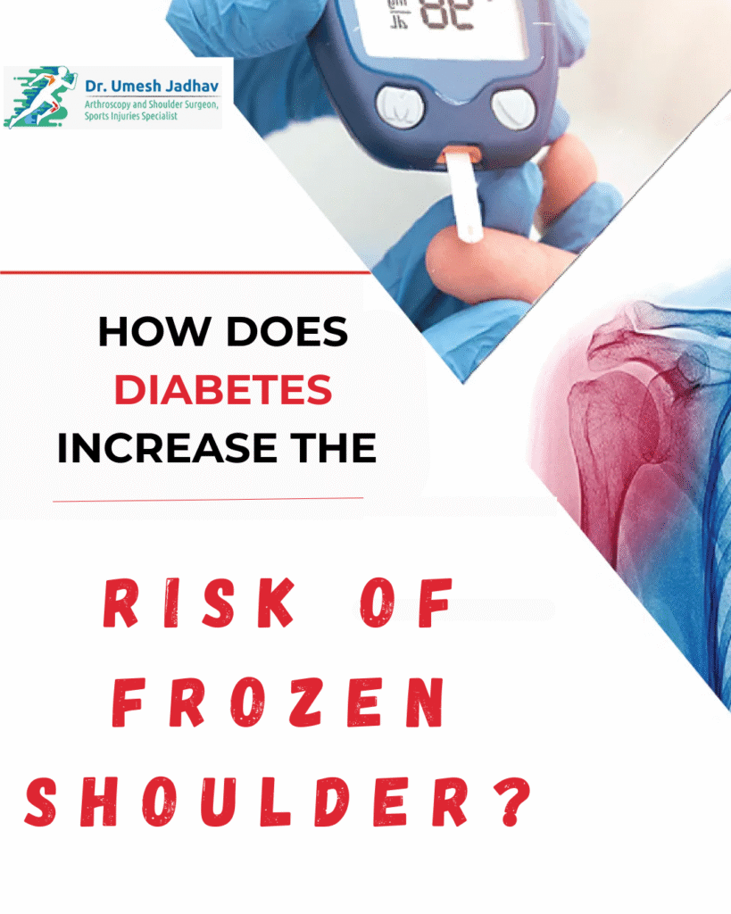 Diabetes Increase the Risk of Frozen Shoulder