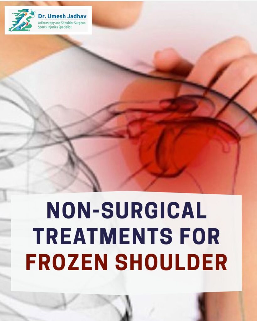 Non-Surgical Treatments for Frozen Shoulder