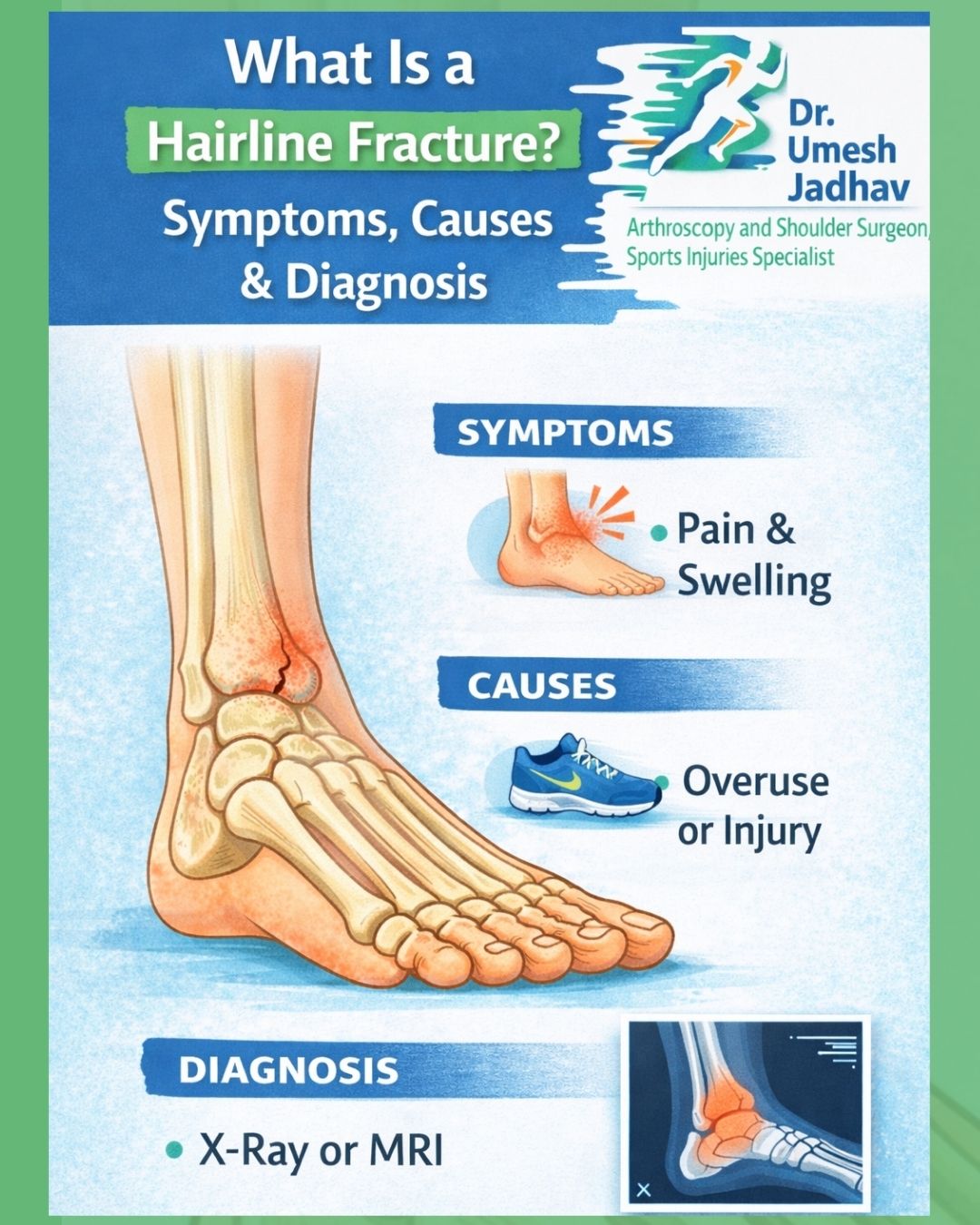 What Is a Hairline Fracture? Symptoms, Causes & Diagnosis Explained