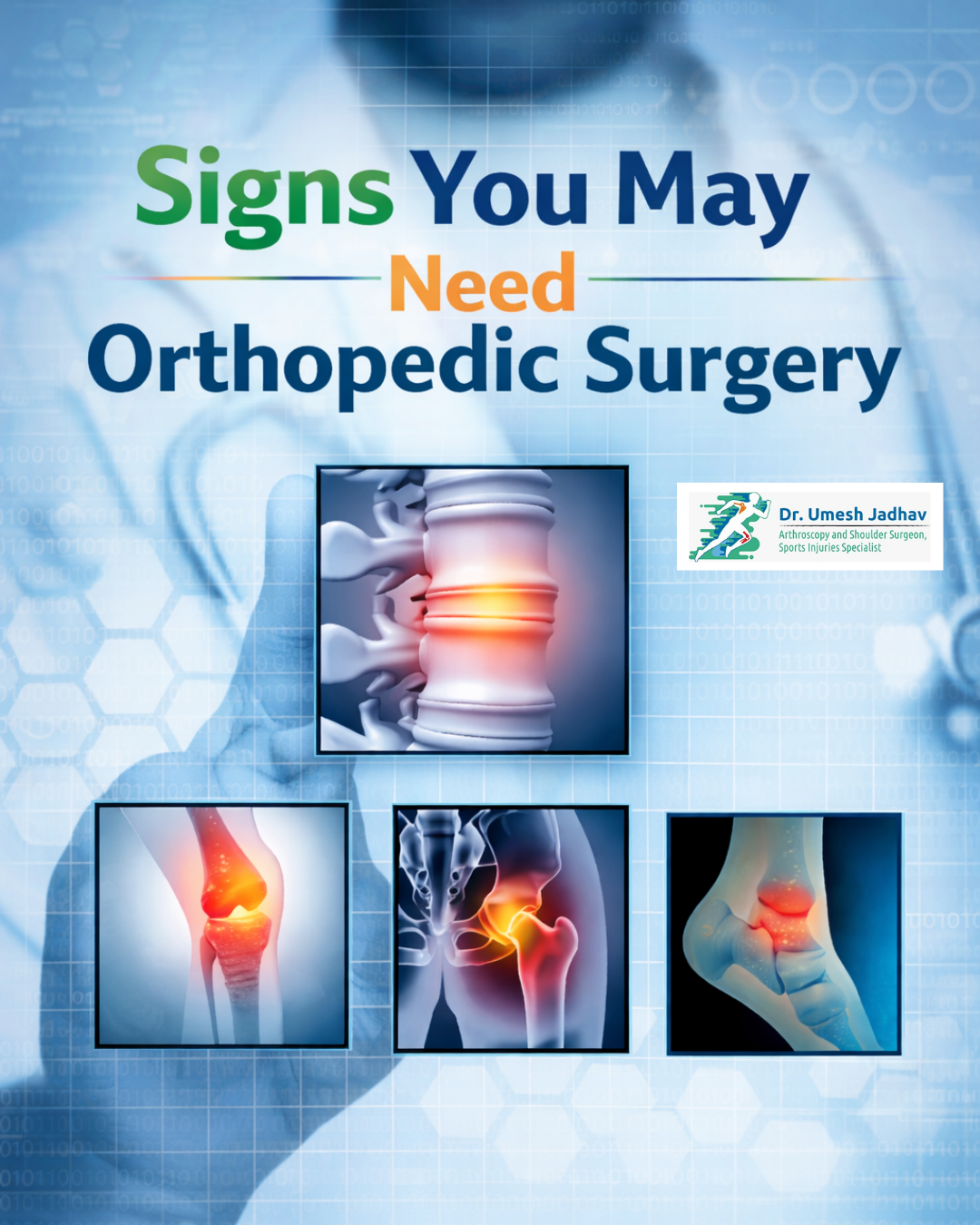 7 Signs You May Need Orthopedic Surgery