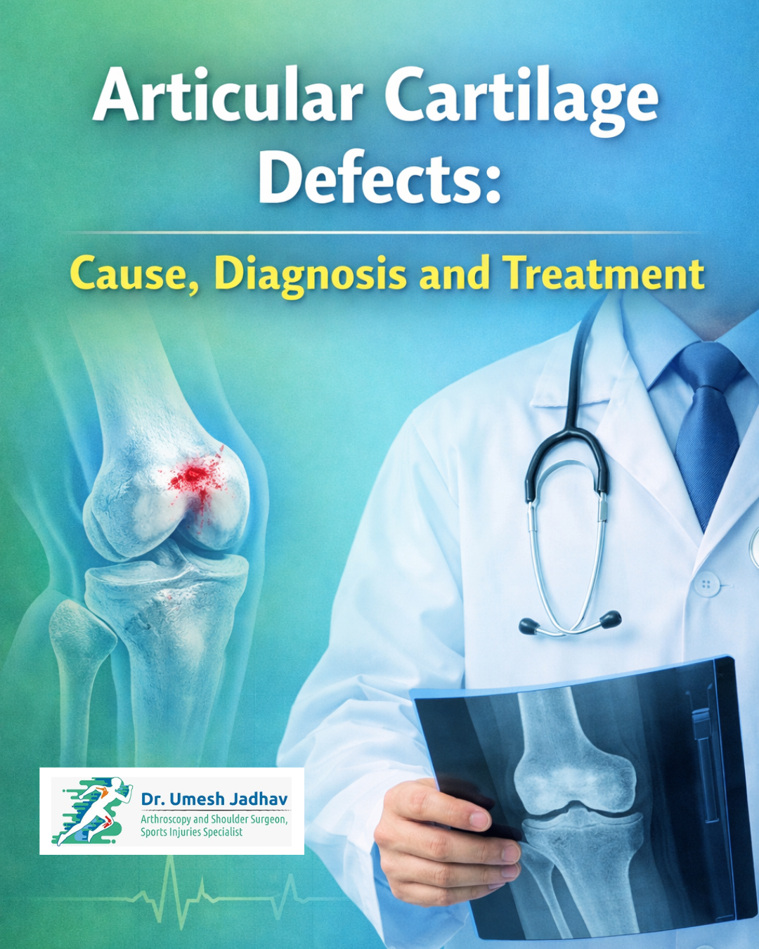Articular Cartilage Defects: Cause, Diagnosis and Treatment