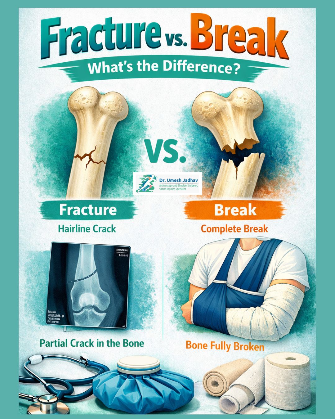Fracture vs. Break: What’s the Difference?