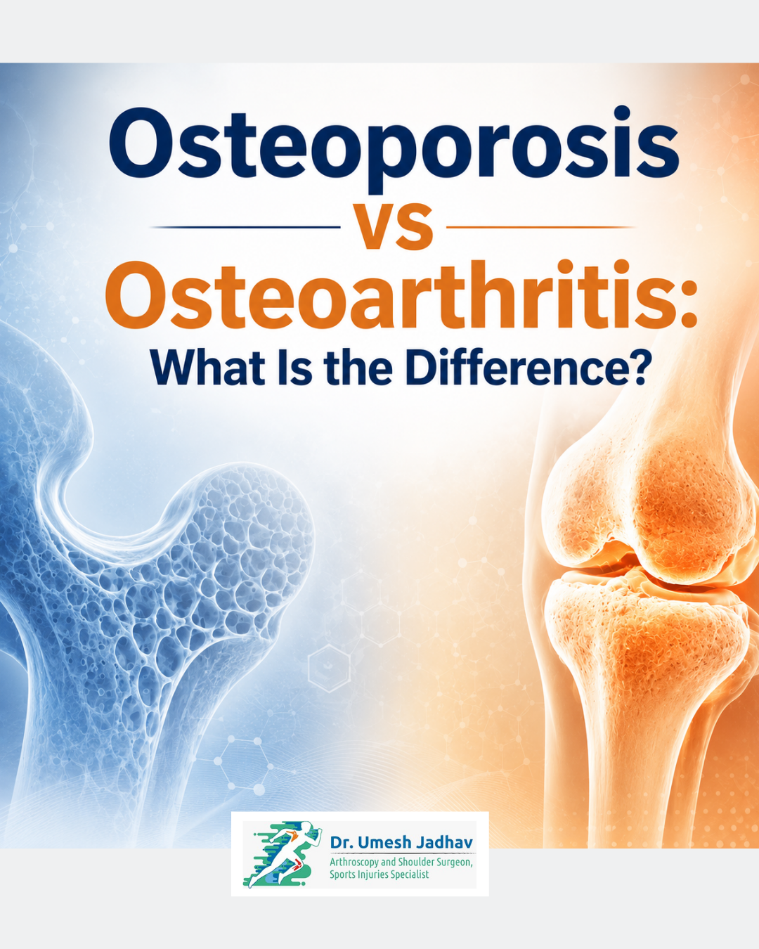 Osteoporosis vs Osteoarthritis: What Is the Difference?
