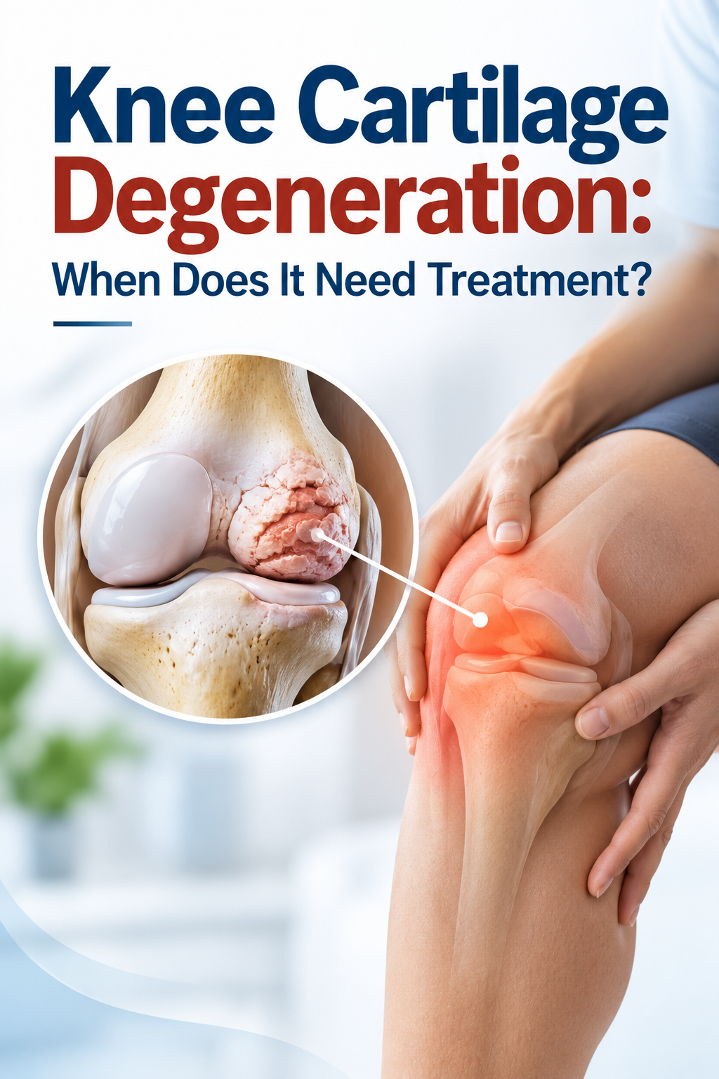 Knee Cartilage Degeneration: When Does It Need Treatment?